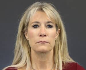 Before Image: Deep Plane Face Lift